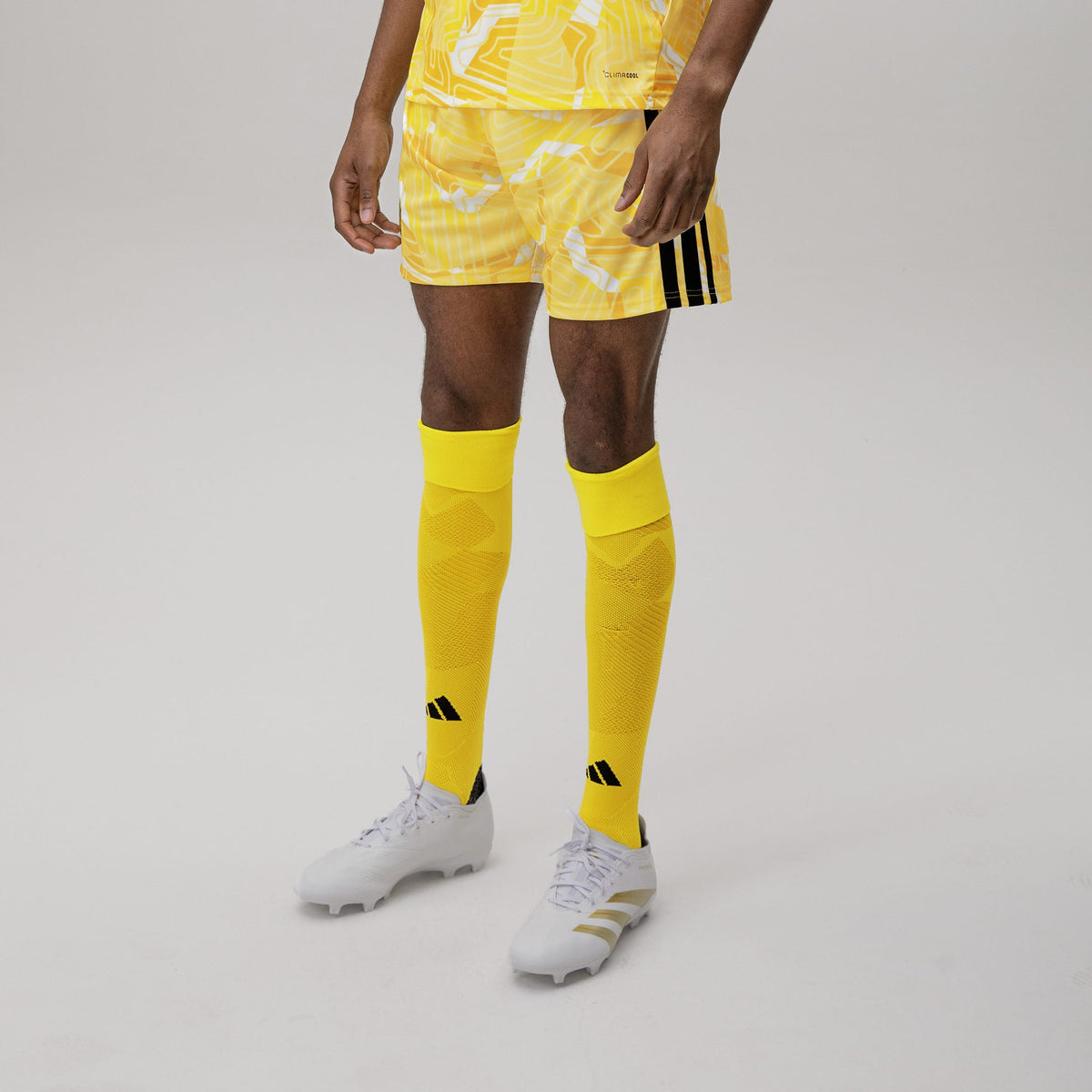 Celtic Men's 2026/27 Home Goalkeeper Shorts